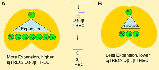 TCR rearrangement involves sequential deletions of intervening DNA sequences in germline DNA resulting in episomal DNA circles (TREC). Dβ-Jβ excision occurs earlier than sj TREC generation, with thymocyte proliferation occurring between the 2 steps. In panel A, greater intrathymic expansion results in higher thymic T-cell output and a higher ratio of sj/Dβ-Jβ TREC when compared to panel B where less intrathymic expansion results in lower thymic output and a lower ration of sj TREC to Dβ-Jβ TREC. With the same expansion seen in panel A (and the same TREC ratio), decreased thymic output would indicate changes either earlier (at the T-cell progenitor stage) or later (such as apoptosis of postrearrangement thymocytes) than the 2 rearrangement steps.