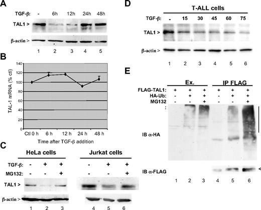 Figure 1. TGF-β induces the proteasome-dependent degradation of TAL1. (A) Decreased expression of TAL1 in the presence of TGF-β. Jurkat cells were treated with 10 ng/mL TGF-β during indicated times, and extracts were prepared from these cells were analyzed by immunoblot using antibodies to TAL1 (top panel) or to β-actin, used here as loading control (bottom panel). (B) TAL1 transcription is not affected by TGF-β. Total RNAs from TGF-β–treated Jurkat cells were purified and analyzed by real-time quantitative RT-PCR for TAL1 mRNA. Quantification was performed with respect to untreated cells and normalized by β-actin mRNA. Mean of 3 measures is represented with standard deviation as percentage with respect to untreated cells. (C) MG132 reverses TGF-β-induced degradation of TAL1. HeLa cells transfected with pSGF-TAL110 (lanes 1 to 3) or Jurkat cells (lanes 4-6) were treated with 10 ng/mL of TGF-β during 9 hours and with or without addition of 10 μM MG132 during the last 6 hours. Cellular extracts were normalized with respect to protein concentration and analyzed by immunoblot using antibodies to TAL1 (top panel) or to β-actin (bottom panel). (D) TGF-β-induced degradation of TAL1 in leukemic cells. Either fresh or frozen cells from 5 patients suffering T-ALL with TAL1 deregulation (4 SIL-TAL1 rearrangement and one translocation t(1;14)) were cultured in RPMI 1640 plus 10% fetal calf serum and were treated without or with 15, 30, 45, 60, and 75 ng/mL TGF-β for 6 hours. Extracts were prepared in radioimmunoprecipitation assay buffer and equal total protein amounts were analyzed by immunoblot as described for panel C. Results from one representative patient are shown. (E) TAL1 is polyubiquitylated. HeLa cells were transfected with 1 μg of pSGF-TAL1 and 0.5 μg of pSG-HA-Ub,12 with or without MG132 treatment as indicated. Cell lysates were immunoprecipitated with an antibody to FLAG. Immunoblot analysis of extracts (lanes 1-3) was done using the antibody to HA and that of immunoprecipitates (lanes 4-6) using antibodies to HA (top panel) and FLAG (bottom panel).