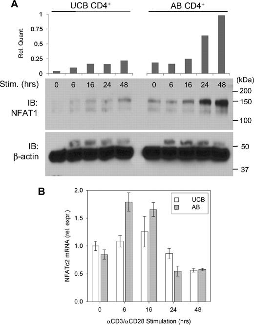 Figure 1. Relative NFAT1 protein and mRNA expression in stimulated UCB and AB CD4+ T cells. (A) Approximately 2 × 106 isolated UCB and AB CD4+ T cells were stimulated in vitro as described for each of the designated time points and Western blot analysis performed. Data are representative of 5 independent experiments. (B) NFATc2 (NFAT1-encoding) mRNA was assayed in stimulated UCB and AB CD4+ T cells by qRT-PCR as described and normalized to UCB at 0 hours. Each bar indicates mean (± SEM) of 2 to 5 independent data points.