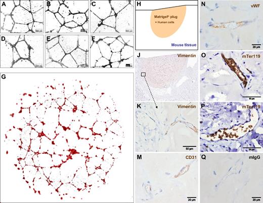 Figure 5. ECFCs function in vitro and in vivo after large-scale humanized expansion. (A-C) Representative transformed images of vascular network formation from 3 typical independent oligoclonal cultures and (D) 1 monoclonal ECFC culture compared with (E,F) 2 independent oligoclonal UCB-derived EPC networks under the same conditions on Matrigel. Nontransformed original phase-contrast microphotographs are documented in higher magnification (Figure S5). Images were captured with an Olympus Color View III camera on an Olympus IX51 microscope (original magnification 20×/0.4 NA objective) with the Olympus analySIS B acquisition software. (G) Serial image reconstruction of one representative complete vascular network created in a 0.4-cm2 well of a 16-well glass chamber slide is shown (Videos S2,3). For in vivo neovasculogenesis, ECFCs from 2 donors were mixed with MSCs in Matrigel before injecting 0.2 mL of the composite subcutaneously in 4 nude mice per group (n = 24; 4 mice per ECFC source analyzed at 3 time points; a macroscopic view is shown in Figure S6D,E). (H) Topography of the histology is symbolized and (J) shown as a low magnification overview of a vimentin-labeled vascularized plug part. (K) Vimentin reactivity in the border area showing murine tissue (left half) in the direct vicinity of the human cell-containing area of the Matrigel plug as indicated in panel J. (M) Antihuman CD31, (N) antihuman VWF, (O,P) antimouse glycophorin A reactivity detected with antibody mTer119 within (O) human and (P) mouse vessels and (Q) representative isotype control reactivity of mouse red blood cell containing vasculature inside the plug.