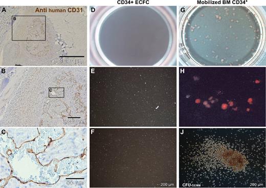Figure 6. Deranged vessel formation of pure ECFCs in vivo and vascular lineage commitment in vitro. (A-C) Representative pure ECFCs (107) derived from large-scale single-step humanized expansion were resuspended in 0.2 mL phosphate-buffered saline and subcutaneously injected into nude mice. After one week, subcutaneous cell deposits (a macroscopic view is shown in Figure S6F) were processed for human CD31 histochemistry. (A) Overview appearance and (B,C) higher magnified regional view as indicated by schematic boxes with scale bars documenting magnification. ECFCs after large-scale expansion were also seeded into methylcellulose for hematopoietic colony-forming cell (CFC) assays. (D,G) Complete (10 cm2) assay plate overview, (E,H), 10× original magnification view, and (F,J) high magnification view that documents (D-F) complete lack of CFCs derived from ECFCs. In comparison, (G,H) regular red blood cell colony formation admixed with a hierarchy of differentially maturating white blood cell colonies and (J) less than 5% colony-forming units of granulocytes, erythrocytes, monocytes, and macrophages (CFU-GEMM) was derived from CD34+ hematopoietic progenitors.