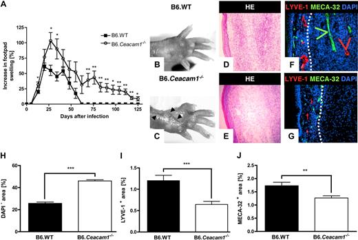 Figure 1. Course of cutaneous leishmaniasis in B6.Ceacam1−/− and B6.WT mice and characterization of local lymphatic and blood vessel formation. (A) Footpad swelling after infection with Leishmania major. Weekly recordings of footpad swelling are shown for B6.Ceacam1−/− (○) and B6.WT mice (■). Footpad swelling is expressed as the percentage of increase of the infected over the noninfected footpad, respectively. Data shown here summarize the mean (± SEM) from 6 animals each; the experiment was repeated 3 times. *P < .05, **P < .01. Photographs of footpads from a B6.WT (B) and a B6.Ceacam1−/− mouse (C) document ulcerations (indicated with ) in the B6.Ceacam1−/− animal on day 41 after infection. (D-G) Representative histologic analyses of cross-sections of the infected footpads of B6.WT (D,F) and B6.Ceacam1−/− mice day 21 after infection (E,G). Cryostat sections were analyzed by H&E staining (D,E) and immune fluorescent labeling (F,G) of lymphatic vessels (anti–LYVE-1 antibody; shown in red), blood vessels (anti–Meca-32 antibody; shown in green), and nuclei (DAPI; shown in blue). The dotted white line indicates the borderline between skin and inflammatory infiltrate. Magnification × 200. (H-J) Quantification of edematous areas and lymph and blood vessel formation in cross-sections of infected footpads of B6.WT (■) and B6.Ceacam1−/− mice (□). Data shown here represent mean (± SEM) from at least 6 specimens. (H) Cell-free areas were determined by quantifying the DAPI-free areas, expressed relative to the total inflammatory area analyzed; ***P < .001. (I) Quantification of lymphatic vessels by calculating the percentage of LYVE-1+ areas in cross-sections of infected footpads; ***P < .001. (J) Quantification of MECA-32+ areas relative to the total areas analyzed and expressed as the percentage of MECA-32+ areas, **P < .01.