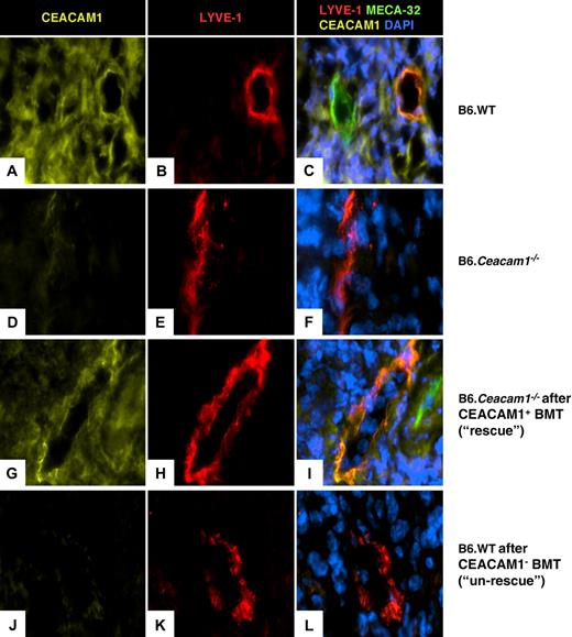 Figure 5. Labeling of CEACAM1, LYVE-1, MECA-32, and nuclei in cross-sections of infected footpads. (A-C) Labeling of CEACAM1 (A, anti-CEACAM1 polyclonal antiserum P1; yellow) shows that the cellular infiltrate in the footpad is CEACAM1+. LYVE-1 is expressed on lymphatic vessels in the infiltrate (B, shown in red). In the overlay (C), coexpression of CEACAM1 and LYVE-1 on lymphatic vessels is shown in B6.WT mice. Blood endothelium (anti–MECA-32 labeling; green) also expresses CEACAM1 (C). In footpads from B6.Ceacam1−/− mice, no CEACAM1 labeling is present (D), and LYVE-1+ structures (E) are CEACAM1− (F). (G-I) After BM transplantation of CEACAM1+ BM into B6. Ceacam1−/− mice (rescue), CEACAM1 labeling is restored in the infected footpads (G), and LYVE-1+ structures (H) coexpress CEACAM1 (I). In the un-rescue experiment after CEACAM1− BM transplantation into B6.WT mice, CEACAM1-expressing cells are absent in the infiltrate (J) and lymphatic vessels (K,L). Representative photographs from 6 animals each are shown; magnification ×630.