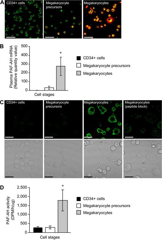 Figure 1. Hematopoietic CD34+ cells differentiated into megakaryocytes accumulate PAF-AH activity. Freshly isolated CD34+ cells (culture day 0), megakaryocyte precursors (culture day 7), or megakaryocytes (culture day 13) adherent to immobilized fibrinogen were used for panels A through D. (A) Wheat germ agglutinin (WGA, green) and integrin αIIb (red) localization; representative of more than 10 independent experiments. Scale bar represents 50 μm. (B) Plasma PAF-AH mRNA was quantified by qRT-PCR and relative values of megakaryocyte precursors and megakaryocytes, normalized to β-actin, were compared with culture day 0 (CD34+ cells). The bars are the mean ± SD for 3 independent experiments. * indicates statistical significance (P < .05) compared with freshly isolated CD34+ cells or megakaryocyte precursors. (C) Plasma PAF-AH localization in megakaryocytes. Results are representative of 3 experiments. (D) PAF-AH activity in cell lysates. The bars in this graph represent the mean ± SD for 3 independent experiments. * indicates statistical significance (P < .05) compared with freshly isolated CD34+ cells or megakaryocyte precursors.