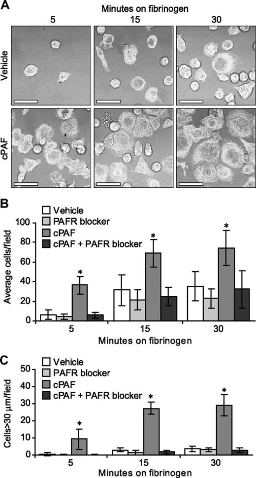 Figure 3. Stimulation of the PAFR increases the rate of megakaryocyte adhesion and spreading on immobilized fibrinogen. (A) Megakaryocytes were placed on immobilized fibrinogen for the designated times in the presence of 10 nM cPAF (bottom row), a stable PAF analog, or its vehicle (top row). β-Tubulin (white stain) was localized in the differentiated megakaryocytes. Scale bar represents 30 μm. (B-C) Megakaryocytes were pretreated with or without the PAFR blocker WEB 2086 (10 μM), and the cells were subsequently placed on immobilized fibrinogen in the presence of cPAF or its vehicle. The number of adherent megakaryocytes (B) or megakaryocytes with diameters greater than 30 μm (C) was determined for each time point. The figure is representative of 5 independent experiments. The bars in panels B and C represent the mean ± SD, and * identifies statistical significance (P < .05) between the treatment groups.