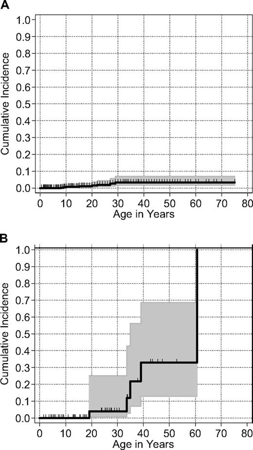 Figure 3. Cumulative incidence by age of development of MDS in cases with dyskeratosis congenita. (A) Cases reported in the literature through 2008, N = 8. (B) Cases enrolled in the NCI IBMFS DC cohort through 2007, N = 5. Data are the cumulative proportion experiencing each event as the cause of failure; shaded area is the 95% pointwise confidence envelope. Vertical lines indicate the age at which patients were censored with or without MDS.