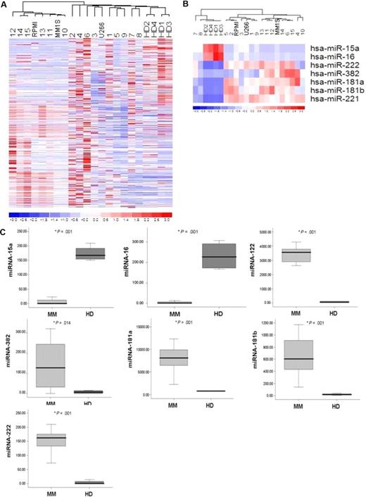 Figure 1. microRNA expression pattern in MM and normal donors. (A) miRNA analysis was performed on total RNA isolated from bone marrow (BM) CD138+ MM cells, normal BM (HD)–derived CD138+ counterparts, and MM cell lines (MM.1S, RPMI8226, U266). The heat map was generated after unsupervised hierarchical cluster analysis of all unfiltered data. Differential expression of miRNA is shown by the intensity of red (up-regulation) versus blue (down-regulation). (B) Supervised hierarchical clustering analysis was performed using the ANOVA test. Differential expression of miRNA patterns is shown by the intensity of red (up-regulation) versus blue (down-regulation). (C) Differential distribution of each indicated miRNA in all MM patients (MM) compared with healthy donors (HD): mean values were compared using Mann-Whitney U rank sum test; bars indicate standard errors; P value (*) for each miRNA is indicated.