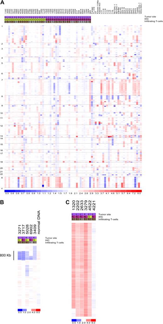 Figure 1. Copy number integrity of the microRNA genome in DLBCL. (A) Genomewide display of loss (blue) and gain (red) of chromosome material targeting the miRNA loci in 73 DLBCL samples. (B) Focal loss of genomic material encompassing miR-491 and miR-31 on chromosome 9 in 5 primary tumors; normal sample DNA also analyzed is displayed alongside. (C) Broad gain of chromosome material targeting the X chromosome in 5 DLBCLs with a diploid tumor is also shown. For all displays, each column represents a different sample (numerical ID for primary tumors), and each row represents an individual oligonucleotide probe. Chromosome numbers are listed on the left side of the figure. The site designation indicates the primary tumor location (L indicates lymph node; X, extranodal); immunohistochemistry (IHC), was performed as described by Hans et al7 to classify the tumors according to germinal center (G) or non-GC (N) categories. The T-cell infiltrate was quantified as described in Table S1: < 5% (1), 5%-15% (2), and 15%-25% (3).