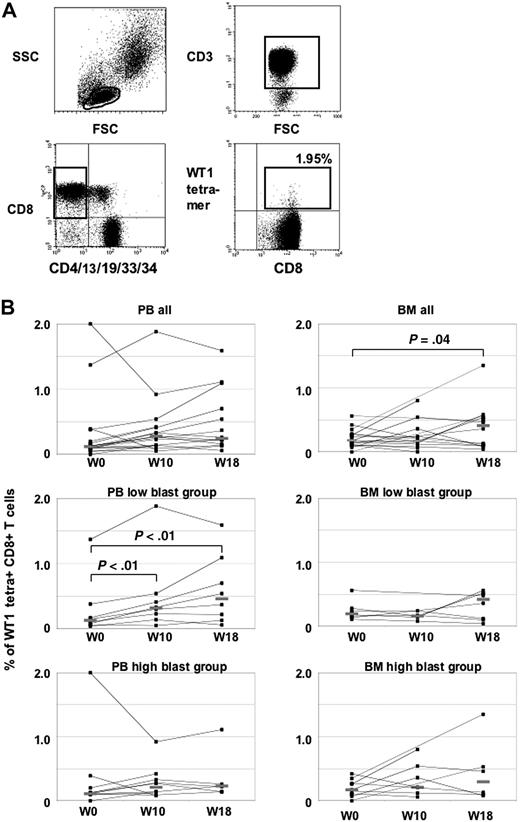 Figure 1. Tetramer analyses in PB and BM. (A) Representative flow cytometry analysis of WT1 tetramers in patient no. 1. Lymphocytes were gated on CD3+ and CD8+ T cells, whereas CD4+, CD13+, CD19+, CD33+, and CD34+ cells were excluded to avoid nonspecific tetramer staining. WT1-specific T cells were calculated as CD8+ tetramer+ T cells. (B) WT1-tetramer CD3+CD8+T cells in PB and BM at baseline and during the course of vaccination. Patients with high and low blasts in BM at baseline are shown separately.