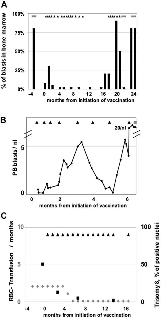 Figure 2. Clinical observations. (A) Patient 1 with initial progression and subsequent mCR lasting for 12 months. ■ indicates the percentage of blasts in bone marrow; and ▴, the time points of vaccinations and the stripes periods of chemotherapy. (B) Patient 9 with initial progression and subsequent transient reduction of PB blasts. The amount of peripheral blasts per nanoliter is shown. ▴ indicates the time points of vaccinations; and the stripes, periods of chemotherapy. (C) Patient 17 with major erythroid response and a molecular response with complete clearance of the trisomy 8 disease marker. (belonging to the left axis) indicates the number of RBC transfusions per months; ■ (belonging to the right axis) shows the percentage of positive nuclei for trisomy 8; and ▴, the time points of vaccinations.