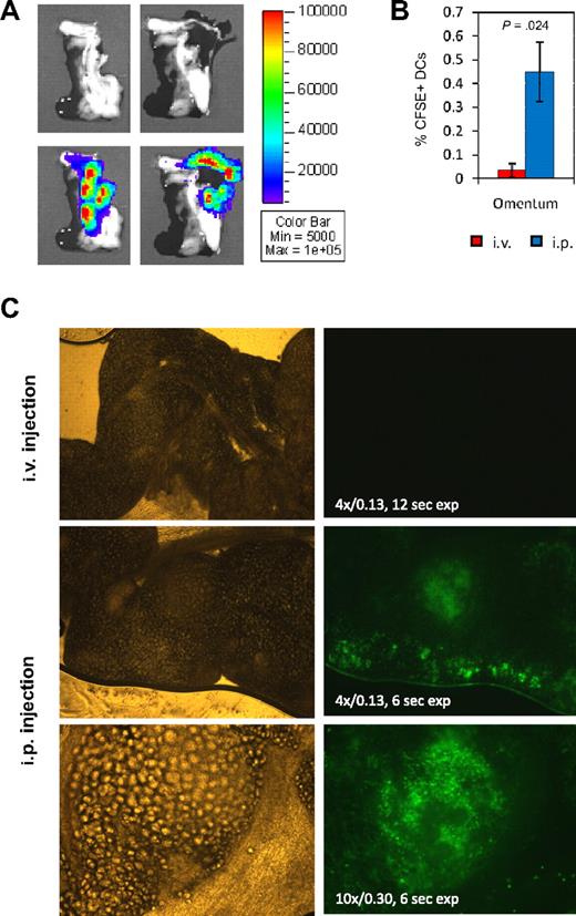 Figure 6. Homing of intraperitoneally injected DCs to omentum. (A) Ex vivo imaging of pancreas from a NOD mouse 3 days after intraperitoneal injection of Luc+ DCs. Omental tissue was detached and turned aside between left and right photos to show that signal comes exclusively from omental and not pancreatic tissue. The tissue was imaged for 5 minutes. Representative data from n = 6 mice equally treated. (B) Percentage of CFSE+ cells in pancreas-associated omentum 2 days after intravenous or intraperitoneal injection of CFSE+ DCs. t test was used for statistical analysis. (C) Visualization of CFSE+ DCs in omentum by fluorescence microscopy 2 days after intravenous or intraperitoneal injection. Brightfield and fluorescence pictures are shown on the left and right side, respectively. Numeric aperture and time of exposure are indicated on the fluorescence picture.