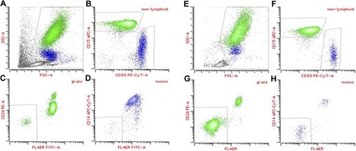 Figure 1. Multiparameter flow cytometry analysis of peripheral blood in PNH. (A-D) Aplastic anemia patient with small (2%) PNH clone; (E-H) classic PNH patient. (A,E) Forward scatter (FSC)/side scatter (SSC) display showing initial gate to exclude lymphocytes and debris. (B,F) Granulocytes (green) are identified as bright CD15 and low CD33, whereas monocytes (blue) are bright CD33 and low CD15. (C,G) Population of GPI anchor protein–deficient granulocytes showing lack of staining with both anti-CD24 and FLAER. (D,H) Population of GPI anchor protein–deficient monocytes showing lack of staining with both anti-CD14 and FLAER.