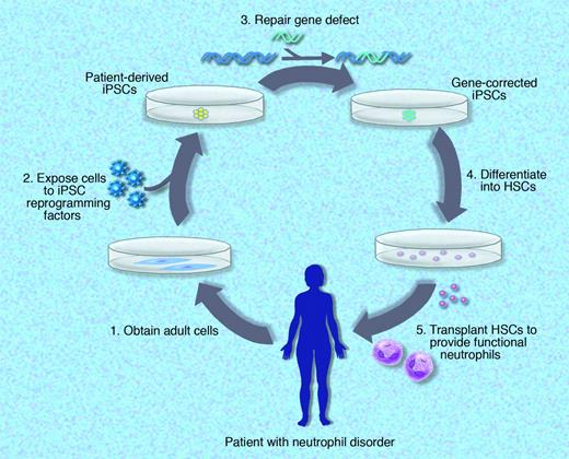 Treatment of genetic neutrophil disorders using patient-derived induced pluripotent stem cells (iPSCs) capable of producing functional neutrophils. Mature cells (fibroblasts or other cell types) could be obtained from the patient and reprogrammed into iPSCs using defined reprogramming factors. Following gene correction or repair, iPSCs could be expanded and differentiated in vitro using the Yokoyama et al or another similar protocol, modified to provide hematopoietic stem cells that are capable of producing functional neutrophils after autologous transplantation. Professional illustration by Marie Dauenheimer.
