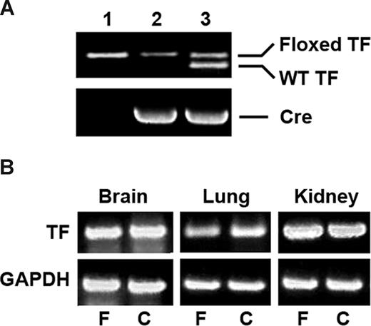 Figure 1. Analysis of VSMC-specific TF-deficient mice. (A) Genomic DNA was isolated from the tails of TFflox/flox mice (lane 1), TFflox/flox/SM22αCre+/− mice (lane 2); and TFflox/+/SM22αCre+/− mice (lane 3). PCR was performed with primers that identify the wild-type and floxed TF alleles and the Cre recombinase. (B) mRNA was isolated from brain, lung, and kidney of TFflox/flox (F) and TFflox/flox/SM22αCre+/− (C) mice and analyzed by RT-PCR for TF. GAPDH was used as an internal control for equal loading.