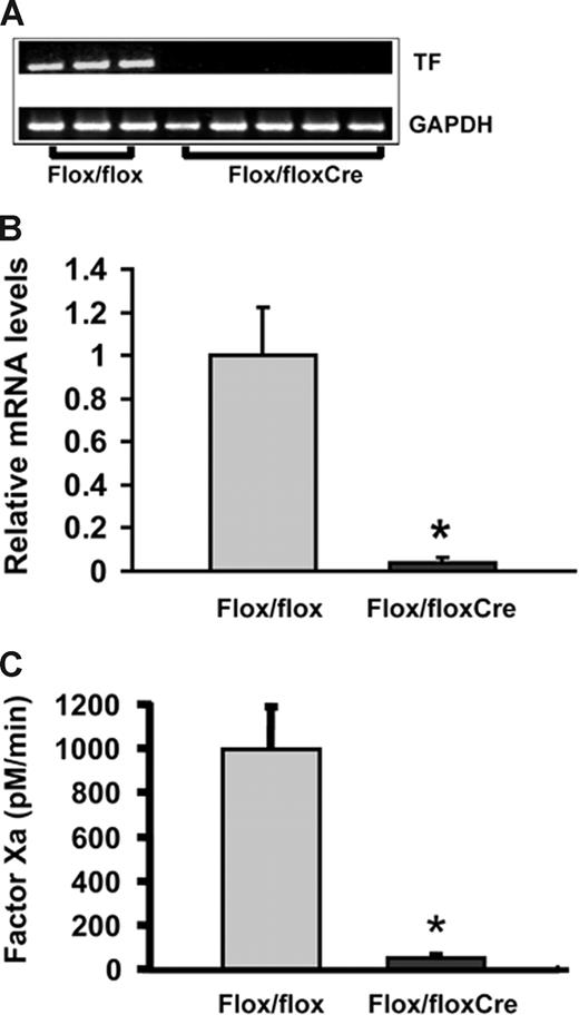 Figure 2. Analysis of TF mRNA and enzymatic activity in mouse aortas. RNA was harvested from the aortic media of TFflox/flox mice (Flox/flox; n = 3) and VSMC-specific TF-deficient mice (Flox/flox/Cre; n = 5) and analyzed for TF mRNA by (A) RT-PCR and (B) real time RT-PCR. For real time RT-PCR, TF mRNA levels in Flox/flox/Cre mice are expressed relative to those of Flox/flox mice, defined arbitrarily as 1.0. (C) TF activity was measured in extracts of aortic media of Flox/floxCre (n = 6) and Flox/flox (n = 4) mice by 2-stage colorimetric Xa generation assay and is expressed as pM factor Xa/min. *P < .05.