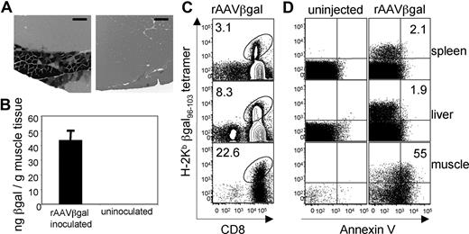 Figure 6. Analysis of CD8+ T cells in quadriceps muscle positive for β-galactosidase. (A) Enzymatic detection of β-galactosidase in rAAVβgal-injected (left) and contralateral (right) quadriceps muscle 168 days after vector administration. Bar represents 100 μm. (B) β-Galactosidase was quantified in muscle by antigen-capture ELISA 56 days after rAAVβ-gal inoculation. (C) Numbers represent the percentage of CD8+ T cells that costain with the H-2Kb βgal96-103 tetramer in spleen, liver and muscle of mice injected with rAAVβgal 56 days earlier. Plots gated as in Figure 1D. (D) Annexin V binding by H-2Kb βgal96-103 tetramer+ CD8+ T lymphocytes from quadriceps muscle, liver, and spleen 56 days after transduction with rAAVβgal. Numbers represent the percentage of tetramer+ cells that bind annexin V. Dot plots gated as in Figure 4A (right panel). Data represent 2 independent experiments each with tissues pooled from 6 mice.
