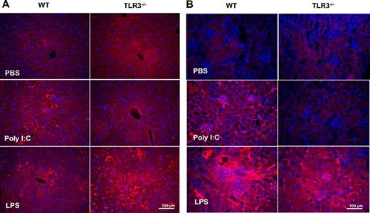 Figure 5. Comparison of the effect of poly I:C and LPS on fibrin(ogen) deposition in WT and TLR3−/− mice in vivo. Mice were treated with poly I:C, LPS, or PBS, and the liver (A) and kidneys (B) were removed for fibrin(ogen) analysis. Sections were stained with an anti–fibrin(ogen) rabbit polyclonal antibody, and the visualization was done with rhodamine-coupled secondary antibody. From each treatment group, 3 mice were analyzed. Slides were counterstained with DAPI to show the nuclei.