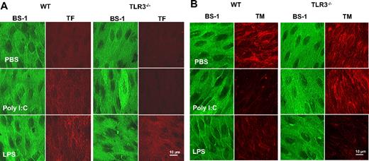 Figure 6. Comparison of the effect of poly I:C and LPS on TF and TM expression in aortic endothelium of WT and TLR3−/− mice in vivo. Mice were treated with poly I:C, LPS, or PBS, and the aortas were removed and processed for enface microscopy. Aortic endothelium from 4 to 6 mice per treatment group was analyzed for TF and TM expression by immunfluorescence analysis using rhodamine-coupled secondary antibody. As a control, each section was also stained with the endothelial marker, BS-1, that was directly labeled with FITC.