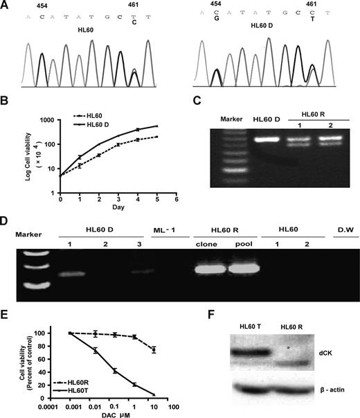 Figure 4. Spontaneous origin of resistance to DAC. (A) Two subclones of the HL60 cell line. HL60D developed a heterozygous 454C>G point mutation of DCK. This mutation was absent in another batch of HL60 obtained from ATCC. (B) The HL60D cell line had a growth advantage over the HL60 cell line. Cell number was counted from day 1 to 7. (C) Heterozygous deletion in exon 1 of DCK in HL60R cells. (D) Deletion was preexisting in HL60D cells and absent in HL60 cells. We designed a set of primers that spanned the deleted region and amplified that region from parental HL60D cells. (E) HL60R cells transfected with DCK restored sensitivity to DAC. We transfected wild-type DCK into HL60R and selected stably transfected cells by G418. HL60R and DCK-transfected (HL60T) cells were treated with DAC at 0.02, 0.2, 2, and 20 μM, respectively. Cell viability was counted. (F) Transfection of DCK cDNA restored dCK protein expression. dCK protein expression was measured in HL60R and HL60T cells by Western blot analysis.