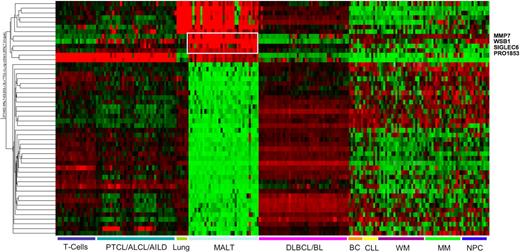 Figure 2. Heatmap representing the expression of genes with significantly different expression in MALT lymphoma compared with all the other lymphomas or normal tissues. The 4 genes overexpressed exclusively in MALT lymphoma are highlighted. The scaling of the heatmap is similar to Figure 1. The gene expression profiling datasets for normal lung and plasma cells and lymphoid neoplasms other than MALT lymphoma were obtained from previously published, publicly available sources as described in “Other gene expression datasets.”