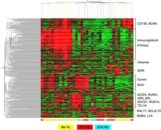 Figure 5. Unsupervised clustering of MALT lymphomas based on genes that are variably expressed across these tumors. The scaling of the heatmap is same as Figure 1.