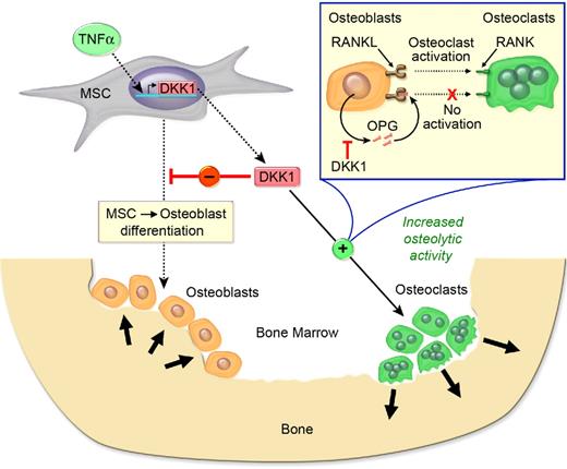 Figure 3. DKK1 is both anabolic and anticatabolic in bone. TNF-α enhances DKK1 secretion which inhibits MSC-derived osteoblastogenesis and lowers OPG levels, resulting in reduced bone accretion. In addition, DKK1 enhances RANKL levels, and the increased RANKL:OPG ratio activates osteoclast activity, leading to bone resorption.