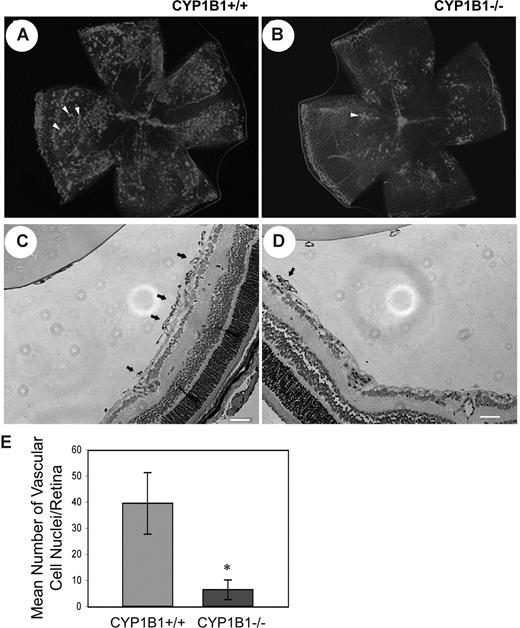 Figure 1. Attenuation of pathologic angiogenesis in CYP1B1−/− mice. CYP1B1+/+ and CYP1B1−/− mice were exposed to a cycle of hyperoxia and room air (OIR). The collagen IV–stained of whole mount retinas prepared from P17 CYP1B1+/+ and CYP1B1−/− mice are shown in panels A and B, respectively (×25). The hematoxylin/PAS–stained eye sections prepared from P17 CYP1B1+/+ and CYP1B1−/− mice are shown in panels C and D, respectively (×100). The arrows indicate growth of new vascular tufts, which is significantly diminished in CYP1B1−/− mice. The number of vascular cell nuclei present on the vitreous side of the retina penetrating the inner limiting membrane was determined as described in “Methods” at P17 and presented in panel E. Data in each bar are the mean number of vascular cell nuclei in 5 eyes of 5 mice (error bars indicate SD). Please note that there is a significant decrease in the degree of retinal neovascularization in CYP1B1−/− mice compared with CYP1B1+/+ mice (n = 20, *P < .05).