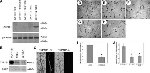 Figure 2. CYP1B1−/− EC fail to undergo capillary morphogenesis in Matrigel. CYP1B1 expression in mouse retinal ECs and C3H10T1/2 cells incubated with and without TCDD (A), and human retinal ECs and umbilical vein ECs (B), were evaluated by Western blot analysis of total cell lysates. The purified human recombinant CYP1B1 protein was used as positive control. β-catenin or β-actin was used as loading control. CYP1B1 or HE/PAS wholemount staining of retinal trypsin digests, prepared from CYP1B1+/+ (right panels) and CYP1B1−/− (left panels) are shown in panel C. Capillary morphogensis of CYP1B1+/+ (D) and CYP1B1−/− (E) retinal ECs were evaluated by plating the cells in Matrigel as described in “Methods.” After 17 hours of incubation, CYP1B1+/+ ECs formed well-organized capillary-like networks, while CYP1B1−/− ECs ability to organize was severely compromised (×40). A similar inhibition can be observed by incubating the CYP1B1+/+ ECs with TMS (F), a specific inhibitor of CYP1B1 activity. Human retinal ECs also form well-organized capillary networks in Matrigel (G), which was attenuated in the presence of TMS (H). The quantitative assessments of the data are shown in panels I and J. Data in each bar are the mean number of branches per 5 high-power fields (×100; error bars indicate standard deviation). Please note that the mean number of branch points formed by CYP1B1−/− ECs or CYP1B1+/+ ECs incubated with TMS were significantly lower than those formed by CYP1B1+/+ retinal ECs (n = 3, *P < .05). These experiments were repeated with 3 different preparations of ECs with similar results.