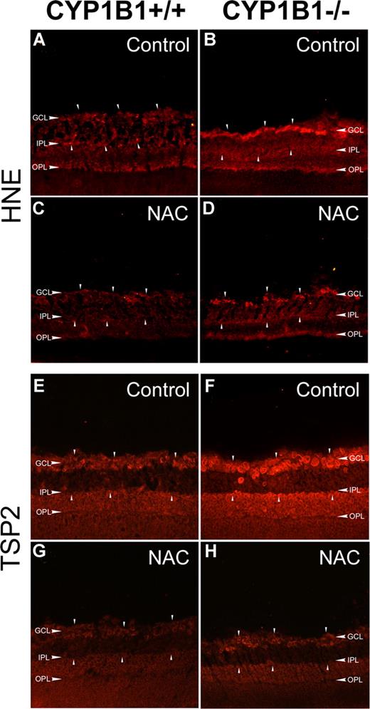 Figure 6. Increased HNE and TSP2 staining in CYP1B1−/− mice retina. Frozen eye sections prepared from P17 CYP1B1+/+ (A,C,E,G) and CYP1B1−/− mice (B,D,F,H) exposed to OIR receiving solvent control (A,B,E,F) or NAC (C,D,G,H; 10 mg/kg in 0.1 mL IP) from P12 to P17, were stained with specific antibodies to HNE (A-D) and TSP2 (E-H) (×200). Please note the marked fluorescence staining for TSP2 and HNE (arrowheads) in CYP1B1−/− retina which are diminished upon administration of NAC compared with CYP1B1+/+ retinas. Sections were treated identically and images were obtained under identical conditions. These experiments were repeated twice with eyes from 4 different mice with similar results.