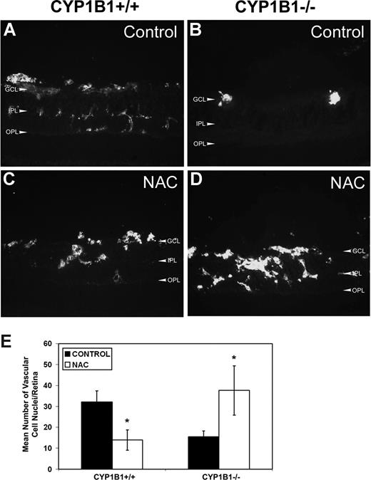 Figure 7. Restoration of retinal vascularization in CYP1B1−/− mice treated with NAC. Frozen eye sections from P17 CYP1B1+/+ (A,C) and CYP1B1−/− (B,D) mice exposed to OIR receiving solvent control (A,B) or NAC (10 mg/kg in 0.1 mL IP) from P12 to P17, were stained with anti-endoglin antibody (×400). Please note significant vascularization in CYP1B1−/− retina treated with NAC compared with solvent control. The degree of neovascularization was quantified as described in Figure 1 and shown in panel E (n = 15, *P < .05).