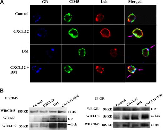 Figure 7. DM-induced effects on CXCL12 migration appear to be Lck-, GCR-, and CD45-dependent. (A) Resting T cells were treated with CXCL12 (100 ng/mL), DM (1 μM), or the combination for 5 minutes and were fixed with 2% paraformaldehyde for 1 hour; 10% donkey serum was used for 1 hour at 37°C to block the slides followed by staining with anti-CD45 antibody for 1 hour. The cells were then permeabilized with 90% methanol for 30 minutes at −20°C. Anti-Lck and GC receptor antibodies were added together in blocking buffer, and the slides were incubated overnight at 4°C. Secondary antibody corresponding for each primary antibody labeled with Alexa Fluor 555, Alexa Fluor 647, and Alexa Fluor 488 for the Lck, GR, and CD45, respectively, was added to the slides and incubated for 1 hour at room temperature. The slides were then mounted with Prolong Gold (Invitrogen) mounting media, and image acquisition was done by a confocal microscope (Carl Zeiss) as previously described.50,51 Isotype controls for each primary antibody were also used in parallel as negative controls. Blue, green, and red indicated the presence of GCR, CD45, and Lck, respectively, and most right panel indicated by the merge of all 3 colors (white). Development of white patches on the merge-image indicated the colocalization of 3 molecules. Single-plane images were examined. (B) Primary human T cells were treated with CXCL12 (100 ng/mL) or DM (1 μM) or a combination for 5 minutes after which the cells were lysed with RIPA buffer. CD45, Lck, and GCR were immunoprecipitated using antibodies to total CD45, Lck, and GCR, respectively. Equivalent amounts of protein were used for immunoprecipitation, and antigen was pulled down from the lysate with antibody-coupled agarose beads after which immunoblotting for each of molecules was performed. Arrows are shown for some of the blots to focus on the bands of interest. See Figure S3 for further quantitation of colocalization after treatment.