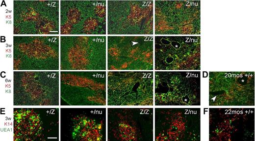 Figure 3. Progressive thymic epithelium phenotypes in Foxn1lacZ mutants. (A-D) Cryosections were stained for Keratin 8 (green) and Keratin 5 (red). Scale bar: 200 μm. Arrowhead, perivascular space; *, cystic structure. (A) Two-week +/lacZ, +/nu, and lacZ/lacZ thymi showed organized cortico-medullary architecture; lacZ/nu thymus also show a breakdown of the cortico-medullary junction (CMJ). (B) At 3 weeks, lacZ/lacZ thymus shows CMJ degeneration, and there was a more severe phenotype in lacZ/nu thymus, with no organized cortical or medullary regions. (C) At 6 weeks, lacZ/lacZ and lacZ/nu thymi had an even more severe defect compared with 3 weeks. (D) A 20-month-old +/+ thymus is shown as a normal involution control. (E,F) Frozen thymus sections stained with anti–Keratin 14 (red) and UEA-1 (green). Scale bar: 200 μm. Both the 3-week lacZ/lacZ and lacZ/nu (E) and the 22-month-old +/+ thymus (F) have fewer UEA-1+ mTECs within K14+ medullary regions.
