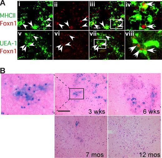 Figure 5. Expression of Foxn1 in postnatal thymus. (A) Cryostat sections of 4-week-old wild-type thymus stained for Foxn1 and either MHCII (i-iv), or UEA-1 (v-viii). MHCIIhi and UEA-1hi cells were associated with bright Foxn1 signals (arrowheads). Scale bar in subpanel iii: 50 μm, applies to subpanels i through iii and v through vii. (iv,viii) Higher magnification views of the boxes in subpanels iii and vii showing colocalization of Foxn1 (nuclear) and MHCII or UEA-1. (B) Loss of Foxn1hi (lacZhi) TECs in aged thymus. X-gal staining on frozen sections of Foxn1+/lacZ thymi at 3 weeks, 6 weeks, 7 months, and 12 months. Eosin counterstaining (pink) is lighter in aged thymus due to lower T-cell density.