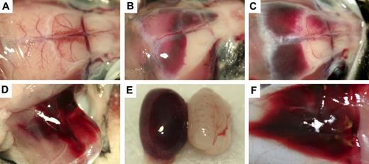 Figure 3. Gross hemorrhage in Mx+fIIlox/− mice after Cre-mediated recombination of the fIIlox allele. (A) Normal brain in a control mouse. (B,C) Dural-based hemorrhage in Mx+fIIlox/− animals after administration of poly I:C. CNS hemorrhage was observed in dural, ventricular, and parenchymal areas of poly I:C-treated Mx+fIIlox/− mice. Additional sites of hemorrhage after recombination of the fIIlox allele include thigh (D), testes (E), and skin (F). Mx+fIIlox/− treated with poly I:C would often have multiple sites of subcutaneous hemorrhage in addition to other more life-threatening areas of hemorrhage.
