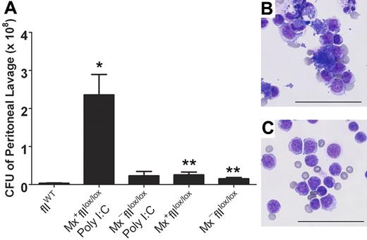 Figure 6. Diminished clearance of S aureus after peritoneal infection in mice that lack prothrombin. (A) Determination of the number of CFU in peritoneal lavage fluid harvested from fIIloxand control mice 1 hour after the intraperitoneal injection of 1 × 109 CFU of bacteria. Values are mean plus or minus SEM. Whereas a modest trend toward decreased bacterial clearance was observed in fIIlox/lox animals in the absence of Cre recombination, the more profound diminution of circulating prothrombin associated with hepatic induction of Cre in Mx+fIIlox/lox mice (5 days after poly I:C treatment) resulted in a dramatic impairment in the ability to clear peritoneal S aureus (*P < .008 vs wild-type; **P < .02 vs wild-type). Representative cytospins of peritoneal lavage fluid collected 1 hour after infection from a Cre-induced Mx+fIIlox/lox animal (5 days after poly I:C treatment) (B) and a wild-type mouse challenged in parallel (C). Note that cytospin preparations from animals lacking prothrombin (B) were characterized by both abundant clusters of free S aureus and bacteria-engorged and disrupted phagocytes, whereas parallel preparations from control mice were largely clear of bacteria. Bars represent 50 μm.