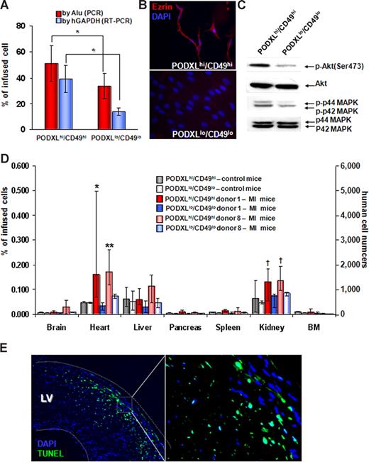 Figure 7. Comparisons of PODXL/CD49f high and low MSCs. (A) PODXLhi/CD49fhi MSCs survive longer in lung after intravenous infusion. One million passage 2 MSCs that were from donor 1 and 8 were infused intravenously into mice with MI. One day after the infusions, DNA was extracted for real-time PCR of Alu sequences and RNA was extracted for real-time RT-PCR for human GAPDH mRNA. Values are expressed as % values obtained with 1 million freshly isolated MSCs that were either PODXLhi/CD49fhi or PODXLlo/CD49flo. *P < .05 by Student t test (n = 5). (B) Immunocytochemistry demonstrating that PODXLhi/CD49fhi MSCs express greater levels of ezrin. The MSCs were from passage 2 of donor 8. (C) Western blot assays demonstrating that PODXLhi/CD49fhi MSCs express greater levels of phosphorylated Akt (p-Akt) and p44/42 MAPK. The MSCs were passage 2 from donor 8. (D) Tissue distributions of intravenously infused MSCs. One million passage 2 MSCs (donor 1 and donor 8) that were either PODXLhi/CD49fhi or PODXLlo/CD49flo were infused intravenously into control mice or mice with MI, and tissues were recovered 1 day after the MSC infusions. Values from real-time PCR assays for human Alu sequences are expressed either as percent of infused human cells or human cell numbers. Error bars indicate range of values. *P < .05 versus PODXLhi/CD49fhi in control mice and P < .05 versus PODXLlo/CD49flo in MI mice by nonparametric Mann-Whitney U test. **P <.05 versus PODXLhi/CD49fhi in control mice and P < .05 versus PODXLlo/CD49flo in MI mice by 2-tailed Student t test. †P < .05 versus PODXLlo/CD49flo in MI mice by 2-tailed Student t test. (E) Terminal deoxynucleotidyl transferase dUTP nick end labeling assay of heart from mice 2 days after MI induction indicating apoptotic cells in region of infarction.