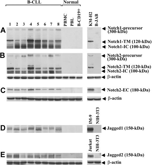 Figure 1. Expression of Notch1, Notch2, Jagged1, and Jagged2 in B-CLL and normal B cells. The expression of Notch1 (A), Notch2 (B,C), Jagged1 (D), and Jagged2 (E) proteins was analyzed by Western blot in whole-cell lysates (25 μg for Notch1 and Notch2 using mAbs directed to N-IC domains, 70 μg for Notch2 using an Ab directed to N-EC domain, and 60 μg for Jagged1 and Jagged2) extracted from freshly isolated B-CLL cells (n = 25) and PBMCs, PBLs, and B-CD19+ cells from healthy donors (n = 5). Results from 8 B-CLL patients having different characteristics and 1 representative healthy donor are shown. Whole-cell lysates isolated from KM-H2 and B-JAB cell lines were used as positive and negative controls, respectively, for receptor expression. Whole-cell lysates isolated from IM-9 and Jurkat cell lines were used as positive controls for Jagged1 and Jagged2 expression, respectively. Whole-cell lysates isolated from NIH-3T3 cell line were used as a negative control for expression of both ligands. Protein loading was assessed by reprobing the blots with an anti–β-actin mAb.