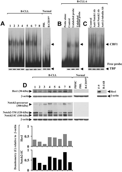Figure 2. Analysis of CBF1-Hes1 nuclear complexes and Hes1 protein expression in B-CLL cells. (A) Nuclear extracts were prepared from freshly isolated B-CLL cells (n = 8) and PBLs and B-CD19+ cells from healthy donors (n = 3). CBF1-binding activity to a 32P-labeled Hes1 probe containing 2 specific sites for CBF1 was evaluated in 10 μg nuclear proteins by EMSA. Results from all 8 B-CLL patients examined and 1 representative healthy donor are shown. (B) For competition assay, nuclear extracts from B-CLL samples were incubated with a 50-fold molar excess of unlabeled Hes1 probe or a 50-fold molar excess of unlabeled mutant Hes1 probe, 10 minutes before the addition of the 32P-labeled specific probe. (C) For blockade of CBF1-binding activity, nuclear extracts from each B-CLL sample were incubated for 12 hours at 4°C with 5 μg anti-Notch1, anti-Notch2, or anti–β-tubulin mAbs, before the addition of the 32P-labeled probe. In panels B and C, the data shown for patient 6 are representative of 8 patients. (A-C) Nuclear extracts (10 μg) used in EMSA were subjected to Western blot analysis with an anti-TBP mAb as a loading control. (D) Whole-cell lysates (25 μg) extracted from freshly isolated B-CLL cells (n = 25) and PBMCs, PBLs, and B-CD19+ cells from healthy donors (n = 5) were analyzed by Western blot for Hes1 expression. Results from 8 B-CLL patients and 1 representative healthy donor are shown. Whole-cell lysates isolated from F-9 and B-JAB cell lines were used as positive and negative controls for Hes1 expression, respectively. Protein loading was assessed by reprobing the blots with an anti–β-actin mAb. The blot of Hes1 along with the blot of Notch2, already shown in Figure 1B, were subjected to densitometric analysis and the density of the bands corresponding to Hes1 and Notch2-IC, expressed as arbitrary units, is reported for each patient. Densitometry units (U) were calculated relative to β-actin for each lane. Lane designations are identical for blots and histograms.