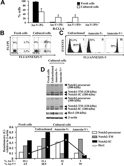 Figure 3. Analysis of Notch1, Notch2, and Hes1 expression in B-CLL cells cultured ex vivo. (A,B) Freshly isolated B-CLL cells were cultured for 24 hours in complete medium (n = 8), and apoptosis was determined by flow cytometric analysis of annexin V/PI–stained cells. Results in panel A (mean ± SD of all 8 patients) and panel B (relative to patient 6 and representative of 8 patients) are presented as the percentage of viable (annexin V−/PI−), early apoptotic (annexin V+/PI−), late apoptotic (annexin V+/PI+), and necrotic cells (annexin V−/PI+). (C) Cultured B-CLL cells were separated into viable and apoptotic fractions (n = 4) using annexin V–coated magnetic microbeads, which bind to cells with external exposure of membrane phosphatidylserine. Flow cytometric analysis of B-CLL cells stained with annexin V–FITC shows unfractioned cells (i), negatively selected viable cells (ii), and positively selected apoptotic cells (iii). The data shown for patient 6 are representative of 4 patients. (D) Whole-cell lysates (25 μg) extracted from the indicated populations were analyzed by Western blot for Notch1, Notch2, and Hes1 expression (n = 4), and protein loading was assessed by reprobing the blots with an anti–β-actin mAb. Densitometry was performed, and the density of the bands corresponding to Notch2-precursor, Notch2-TM, Notch2-IC, and Hes1, expressed as arbitrary units, is reported for each cell population. Densitometry units (U) were calculated relative to β-actin for each lane. The data shown for patient 6 are representative of 4 patients.