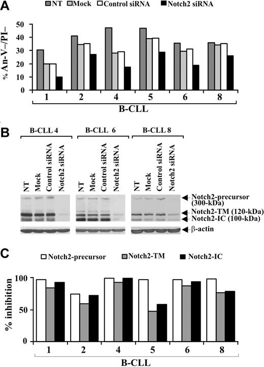Figure 5. Effect of Notch2 down-regulation on B-CLL cell survival. Freshly isolated B-CLL cells were nontransfected (NT), mock-transfected (no siRNA), or transfected with 0.5 μM control nontargeting or Notch2 siRNA (n = 6) as described in “siRNA nucleofection” and then cultured in complete medium for 72 hours. (A) Cell viability was evaluated by annexin V/PI staining, and the results from each patient are presented as the percentage of annexin V−/PI− cells. (B) Notch2 protein expression was analyzed by Western blot in 25 μg whole-cell lysates from the indicated cell populations, and protein loading was assessed by reprobing the blots with an anti–β-actin mAb. The results shown for patients 4, 6, and 8 are representative of 6 patients. (C) For each sample, blot lanes corresponding to control nontargeting and Notch2 siRNA were subjected to densitometric analysis and normalized to β-actin levels. Columns represent the percentage inhibition of Notch2-precursor, Notch2-TM, and Notch2-IC induced by Notch2 siRNA compared with control siRNA.