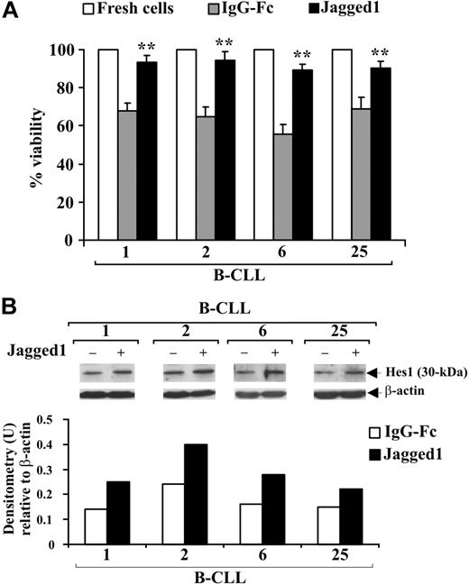 Figure 6. Effect of soluble Jagged1 ligand on B-CLL cell survival. Freshly isolated B-CLL cells were cultured for 48 hours in complete medium with 10 μg/mL (100 μL/well) immobilized soluble Jagged1 ligand or IgG-Fc as control (n = 4) as described in “Soluble Jagged1 ligand immobilization and B-CLL cell stimulation.” (A) Cell viability was evaluated by trypan blue exclusion. Data for each patient are expressed as mean plus or minus SD of 4 determinations. **P less than .01, Jagged1-treated cells vs IgG-Fc–treated cells for each patient, according to the Student t test. (B) Hes1 protein expression was analyzed in 25 μg whole-cell lysates by Western blot, and protein loading was assessed by reprobing the blots with an anti–β-actin mAb. Densitometry was performed, and the density of the bands expressed as arbitrary units is reported for each patient. Densitometry units (U) were calculated relative to β-actin for each lane. Results from all 4 patients examined are shown.