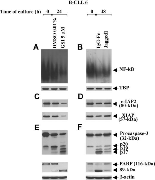 Figure 7. Effect of soluble Jagged1 ligand and GSI treatment on NF-κB activity, c-IAP protein expression, and caspase activation. Freshly isolated B-CLL cells (n = 3) were cultured for different times in 2 different conditions: for 24 hours in culture tubes at a density of 2 × 106/mL (3 mL/tube) with GSI 5 μM or DMSO as control (A,C,E), or for 48 hours in 96-well plates at a density of 106/mL (100 μL/well) on immobilized soluble Jagged1 ligand or IgG-Fc as control (B,D,F). NF-κB–binding activity to a 32P-labeled specific probe was evaluated by EMSA in 5 μg nuclear proteins extracted from the indicated cell populations (A,B). Nuclear extracts (5 μg) used in EMSA were subjected to Western blot analysis with an anti-TBP mAb, as a loading control (A,B). c-IAP2 and XIAP expression (C,D), caspase-3 processing, and PARP degradation (E,F) were analyzed by Western blot in 30 μg whole-cell lysates. Protein loading was assessed by reprobing the blots with an anti–β-actin mAb. The data shown for patient 6 are representative of 3 patients.