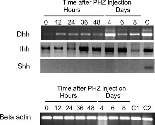 Figure 4. Expression of Hedgehog family members in the spleen. (Top) RT-PCR analysis of Ihh, Shh, and Dhh in the spleen at the indicated times after induction of acute anemia by PHZ injection. C indicates positive control RT-PCR analysis for Ihh, Dhh, and Shh. Dhh control used spleen RNA, and Ihh and Shh controls used thymus RNA. (Bottom) β-Actin control RT-PCR was used as a loading control. C1 indicates Dhh control RNA; C2, control RNA for Ihh and Shh.