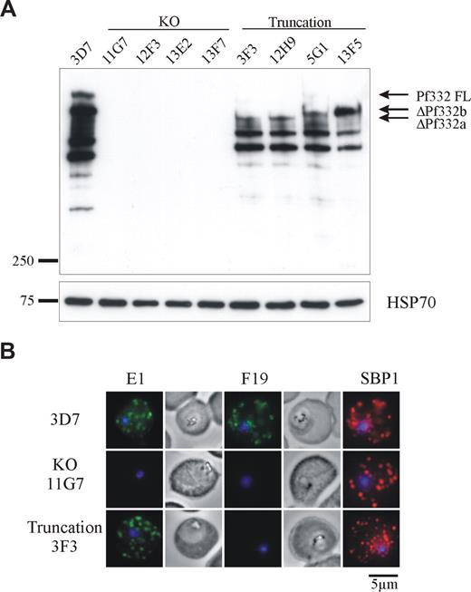 Figure 2. Expression of Pf332 is abolished in 3D7ΔPf332 KO clones or expressed as a smaller, truncated protein in 3D7ΔPf332a and 3D7ΔPf332b clones. (A) Western blot analysis of Pf332 expression in 3D7 parasites, 3D7ΔPf332 KO clones (11G7, 12F3, 13E2, and 13F7), and the 3D7ΔPf332a (3F3 and 12H9) and 3D7ΔPf332b (5G1 and 13F5) clones. Membranes were probed with antibodies raised against the NH2-terminal region of Pf332. Bands corresponding to full-length Pf332 (Pf332FL), or the size-truncated proteins ΔPf332b and ΔPf332a are indicated. An identical blot was probed for HSP70 as a parasite loading control. Densitometric quantitation with NIH ImageJ open source software (National Institutes of Health, Bethesda, MD) of total Pf332 reactivity for 3D7 and each of the truncation mutants (corrected for equal loading of iRBCs) revealed that all mutants express similar levels of protein, which was approximately half the amount of full-length Pf332 expressed by 3D7 parasites (total Pf332 expressed as percentage of 3D7 = 41%, 39%, 53%, and 44% for clones 3F3, 12H9, 5G1, and 13F5, respectively). (B) Immunofluorescence analysis of iRBCs infected with 3D7, 3D7ΔPf332 (11G7), or 3D7ΔPf332a (3F3). iRBCs were incubated with antibodies raised against the N-terminal (E1) or C-terminal (F19) regions of Pf332, or with the MC marker SBP1. Note that no fluorescence of the MCs or iRBC membrane could be detected in the 3D7ΔPf332 KO clones. Parasite nuclei were counterstained with DAPI.