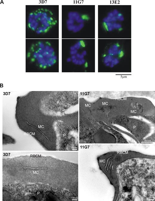 Figure 3. Abnormal morphology of MCs is observed in RBCs infected with mature-stage parasites. (A) Immunofluorescence analysis of 3D7 or 3D7ΔPf332 (11G7 or 13E2) schizont-infected RBCs containing 8 or more DAPI-stained nuclei. MCs were visualized with antibodies raised against SBP1. Greater than 60% of transgenic Pf332KO iRBCs showed fewer and abnormally large MCs compared with 3D7 iRBCs. A total of 2 typical iRBCs are shown for each parasite line. (B) Electron micrographs of thin sections through RBCs infected with late-stage parasites (P), either the parental line (3D7) or the Pf332 KO clone (11G7), showing the ultrastructure and arrangement of Maurer clefts (MC) underlying the RBC membrane (RBCM). Note that MCs are stacked and aggregated in the absence of Pf332.