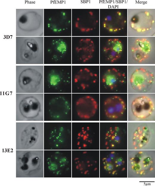 Figure 7. PfEMP1 is correctly trafficked to MCs in Pf332 KO lines. Immunofluorescence analysis of 3D7 or 3D7ΔPf332 (11G7 or 13E2) iRBCs with anti-VARC antibody shows punctate PfEMP1 fluorescence consistent with its localization in MC. Double labeling with anti-VARC (green) and anti-SBP1 (red) antibodies shows coresidence of PfEMP1 in some (but not all) of SBP1-positive MCs. A total of 2 representative RBCs are shown for each transgenic parasite line and show no detectable difference between the intracellular localization of PfEMP1 in 3D7 parasites or either of the Pf332 KO clones.