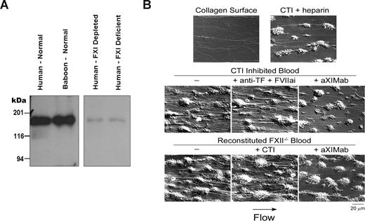 Figure 2. The anti-FXI monoclonal antibody binds human and baboon FXI, and inhibits fibrin formation in FXII-inhibited or deficient human blood under flow. (A) Binding of the anti-FXI monoclonal antibody (aXIMab) to the FXI dimer (160 kDa) in platelet free NHP and NBP was demonstrated by Western blotting, developed using a secondary anti–mouse IgG antibody. aXIMab binding was minimal in FXI-depleted plasma or plasma from a FXI-deficient patient. (B) aXIMab prevented visible fibrin formation in FXII-inhibited or deficient blood under flow. Human whole blood, anticoagulated with CTI (40 μg/mL) to inhibit FXIIa, or reconstituted FXII deficient human blood was perfused through collagen-coated capillary tubes (thrombus chambers) at a shear rate of 265 s−1 for 10 minutes. Before each experiment, blood was incubated with unfractionated heparin (15 U/mL), anti-TF antibody (20 μg/mL) plus FVIIai (1 μg/mL), aXIMab (20 μg/mL), CTI (40 μg/mL) for reconstituted blood where indicated, or PBS vehicle (−), as marked above each panel. Images were obtained via Kohler-illuminated Nomarski differential interference contrast microscopy with a Zeiss Axiovert 200M microscope using a Zeiss 63× oil-immersion 1.40 NA plan-apochromat lens (Zeiss, Göttingen, Germany). Images were captured using a Zeiss AxioCam with Slidebook 4.0 (Intelligent Imaging Innovations, Denver, CO) after 3 minutes of perfusion with modified Tyrodes buffer to wash the thrombus of unbound cells. All experiments were performed at 37°C. Each image is representative of 2 or 3 experiments.
