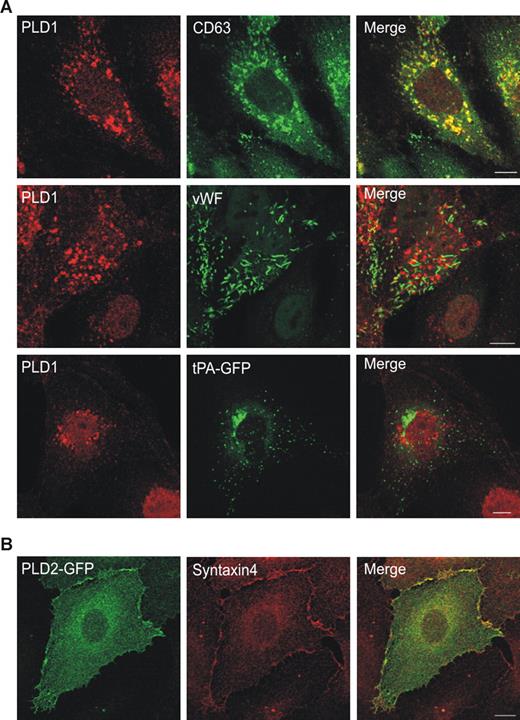 Figure 1. Localization of PLD isoforms in HUVECs. (A) Subcellular localization of endogenous PLD1 in resting HUVECs. Fixed and permeabilized HUVECs were stained with antibodies against PLD1 and anti-human LAMP3/CD63 (top panels) or anti-human VWF antibodies (middle panels). In the bottom panels, the anti-PLD1 staining is compared with the distribution of exogenously expressed tPA-GFP. (B) Colocalization of GFP-tagged PLD2 and syntaxin 4 in resting HUVECs. Bars represent 10 μm.