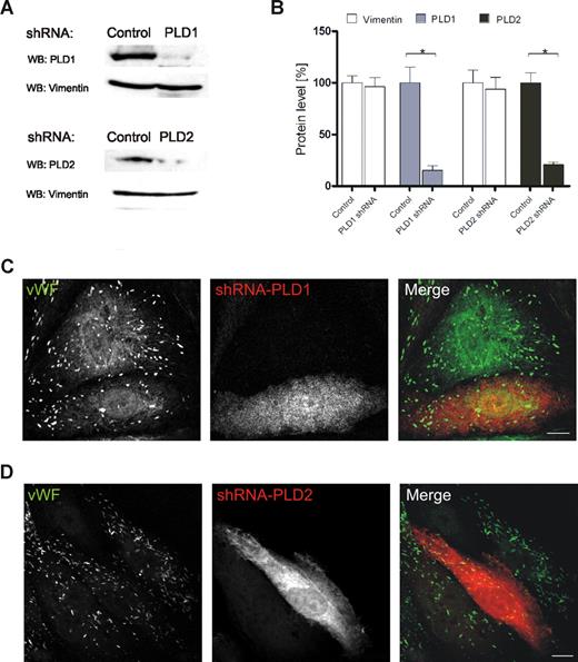Figure 4. siRNA-mediated down-regulation of PLD isoforms does not affect the number or appearance of WPbs. HUVECs were transiently transfected with either nontargeting shRNA plasmids or shRNA plasmids targeted at PLD1 or PLD2. (A) Forty-eight hours after transfection, PNS were prepared and analyzed by Western blot analysis using rabbit polyclonal anti–PC-PLD1 and anti–PC-PLD2 as well as monoclonal anti-vimentin antibodies (loading controls). (B) Quantification of PLD1 and PLD2 down-regulation. Signal intensities were quantified by densitometric analysis using the ImageJ software (NIH). Statistical significance (*P < .01) of the results obtained from 3 independent experiments was evaluated by unpaired Student t test. (C,D) WPb distribution in shRNA-transfected cells. Transfected cells were identified by fluorescence of the plasmid encoded dsRed and WPbs were visualized by labeling with monoclonal anti-human VWF antibodies. Transfection rates typically were in the range of 70% to 90%. Images shown here were chosen to show nontransfected and transfected cells in the same frame. Note that the anti-VWF staining is not affected by PLD1 (C) or PLD2 (D) depletion. Bars represent 10 μm.