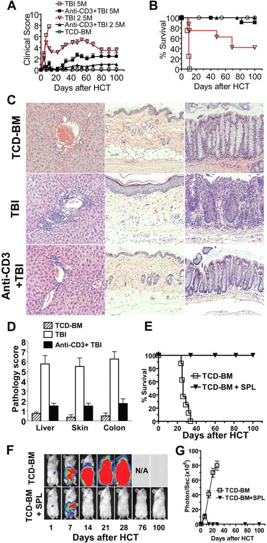 Figure 1. Anti-CD3 preconditioning separated GVL from GVHD in recipients conditioned with TBI. BALB/c mice were preconditioned with anti-CD3 on day −9. The mice were conditioned with 800 rads sublethal TBI on day 0. Six hours later, the mice were injected intravenously with TCD-BM cells (5 × 106) and spleen cells (2.5 or 5 × 106) from C57BL/6 donors. There were 12 mice in each group combined from 3 replicate experiments. (A) Clinical score. (B) Survival percentage. (C,D) Liver, skin, and colon tissues from the recipients conditioned with TBI with or without anti-CD3 preconditioning were evaluated for tissue inflammation and damage 60 days after HCT. A representative histopathology and the mean plus or minus SE of 6 recipients in each group are shown. (E-G) BALB/C recipients that were preconditioned with anti-CD3 were injected intravenously with BCL1 cells transfected with luciferase (Luc+) and donor TCD-BM and spleen cells (2.5 × 106). There were 8 mice in each group combined from 2 replicate experiments. The survival percentage, representative photographs of in vivo BLI of Luc+ BCL1 cells, and the intensity (photo/second) of BLI are shown.